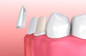 cosmetic dentist in burlington, north carolina