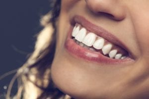 cosmetic dentist burlington nc