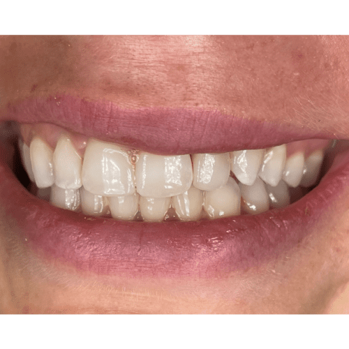 Dentistry in Burlington North Carolina