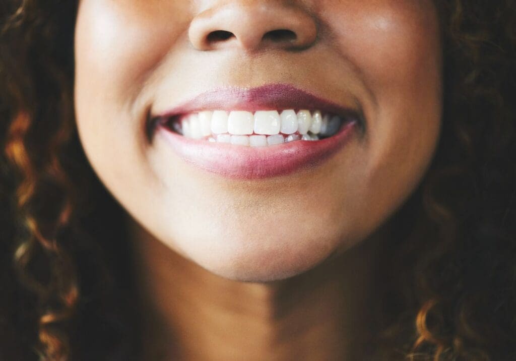 close up image of woman smiling with straight white teeth cosmetic dentistry dentist in Burlington North Carolina