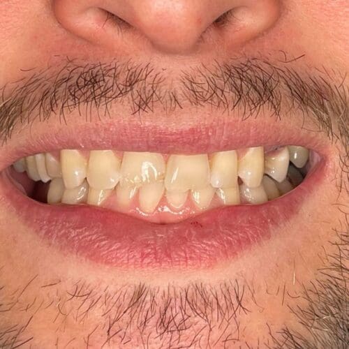 Dentistry in Burlington North Carolina