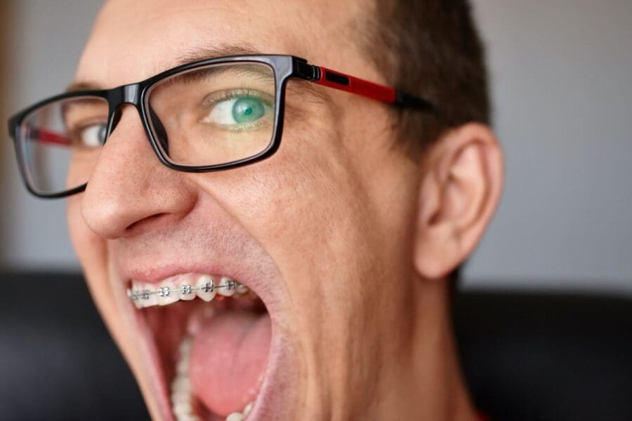 What is Orthodontic Relapse? Dentists in Burlington, NC